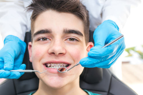 Dentist,With,Tools,In,The,Young,Man's,Mouth,With,Orthodontics